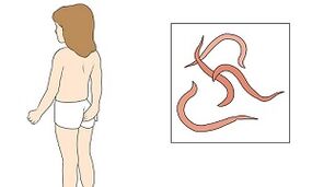 Parasitensymptome im menschlichen Körper