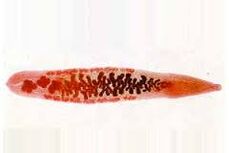 Was Parasiten im menschlichen Körper leben können